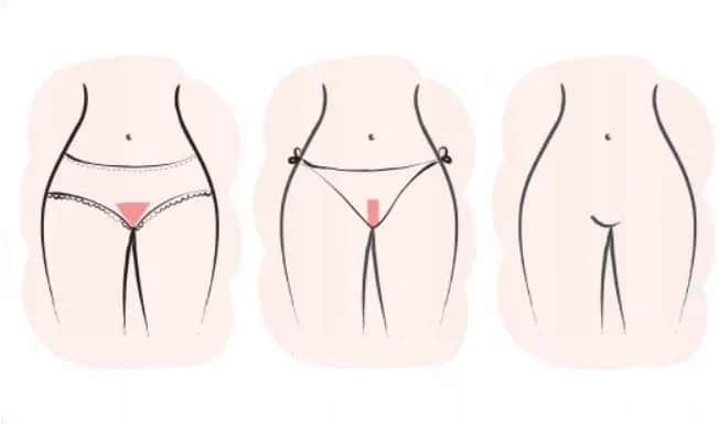 Jak złagodzić podrażnienia po goleniu miejsc intymnych skutecznie