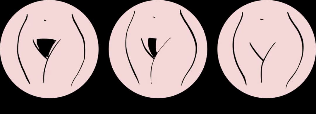 Jak wygląda depilacja bikini? Proces, efekty i najczęstsze obawy