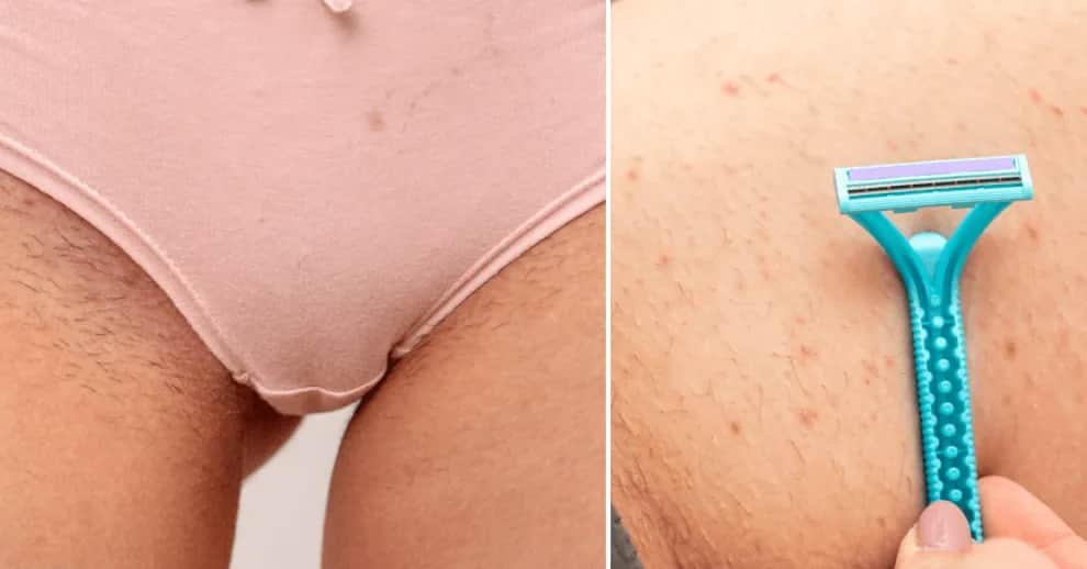 Jak golić miejsca intymne bez podrażnień - sprawdzone porady