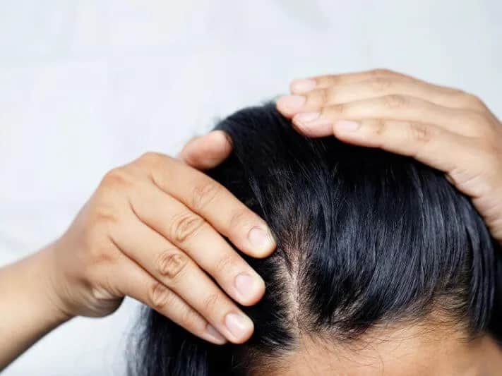 Jak zrobić peeling do skóry głowy, aby uniknąć problemów z włosami