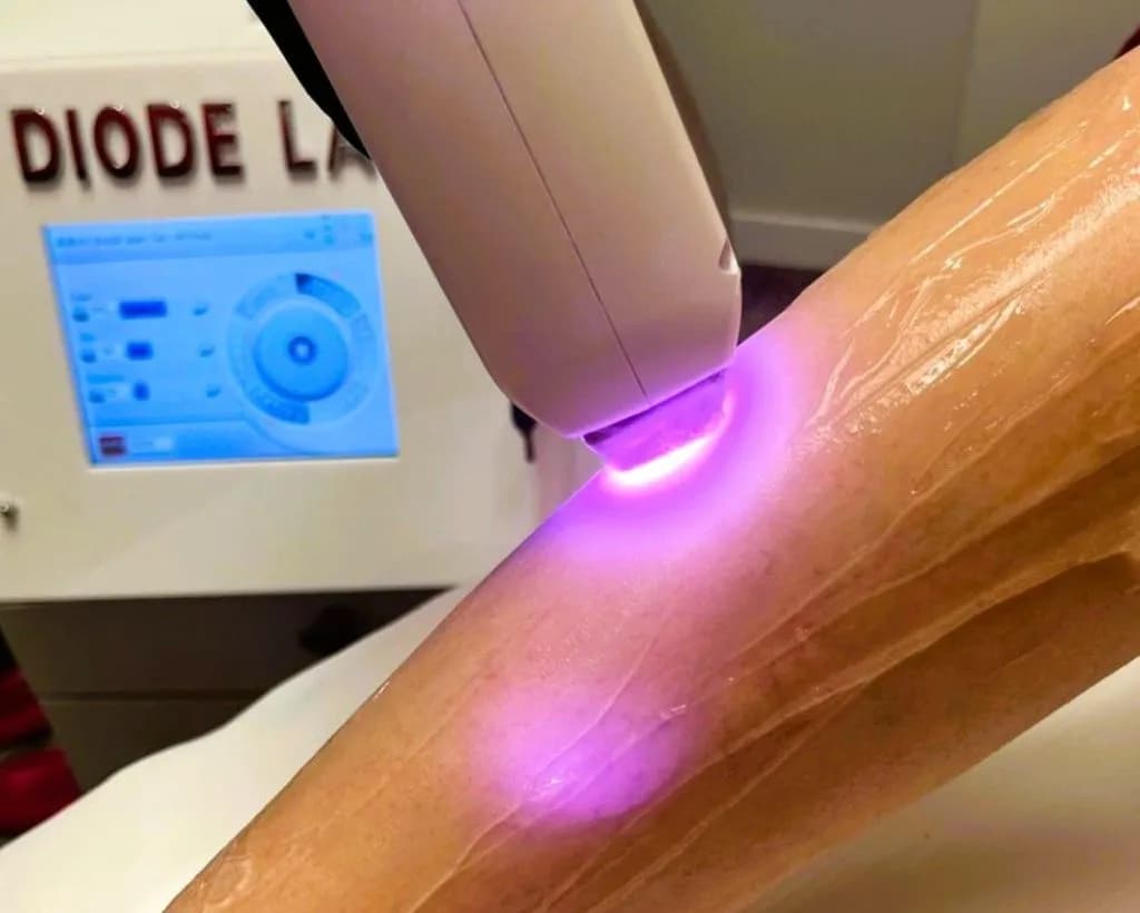Jak działa depilator laserowy? Poznaj skuteczność i bezpieczeństwo