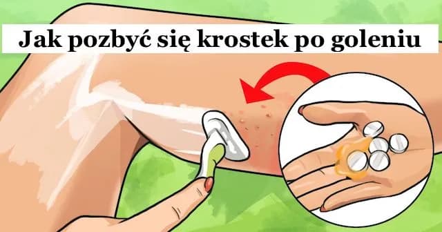 Jak pozbyć się krostek po goleniu - skuteczne metody i porady
