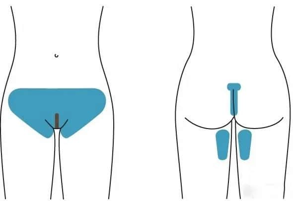 Jak depilować miejsca intymne bez podrażnień - sprawdzone metody