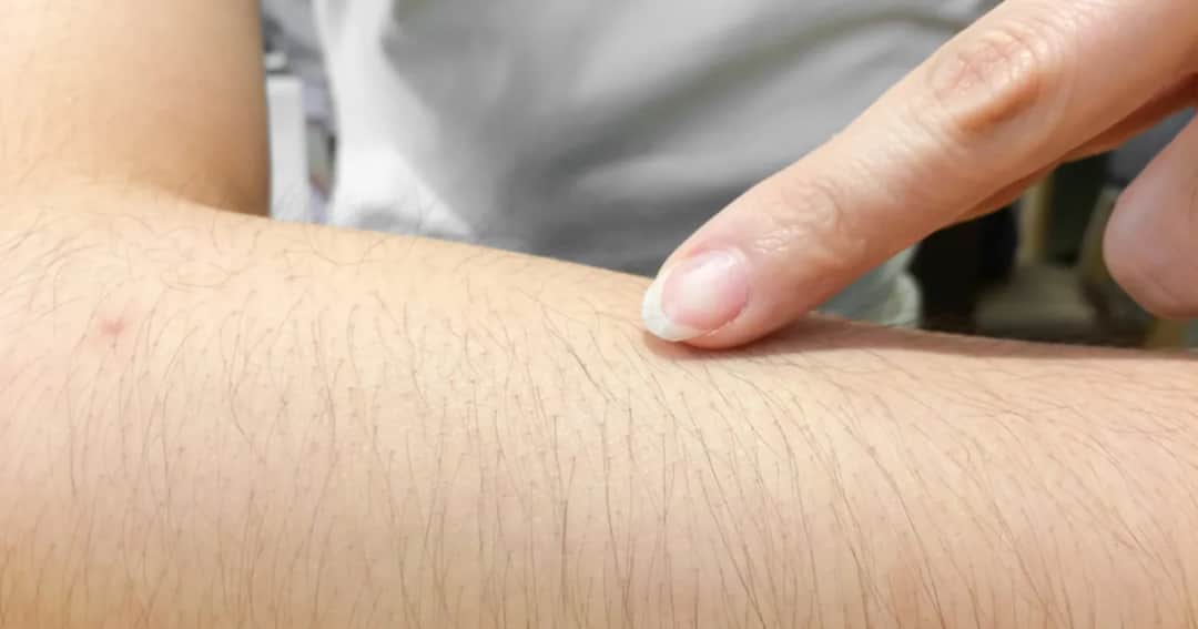 Jak golić ręce bez podrażnień - skuteczne techniki i porady