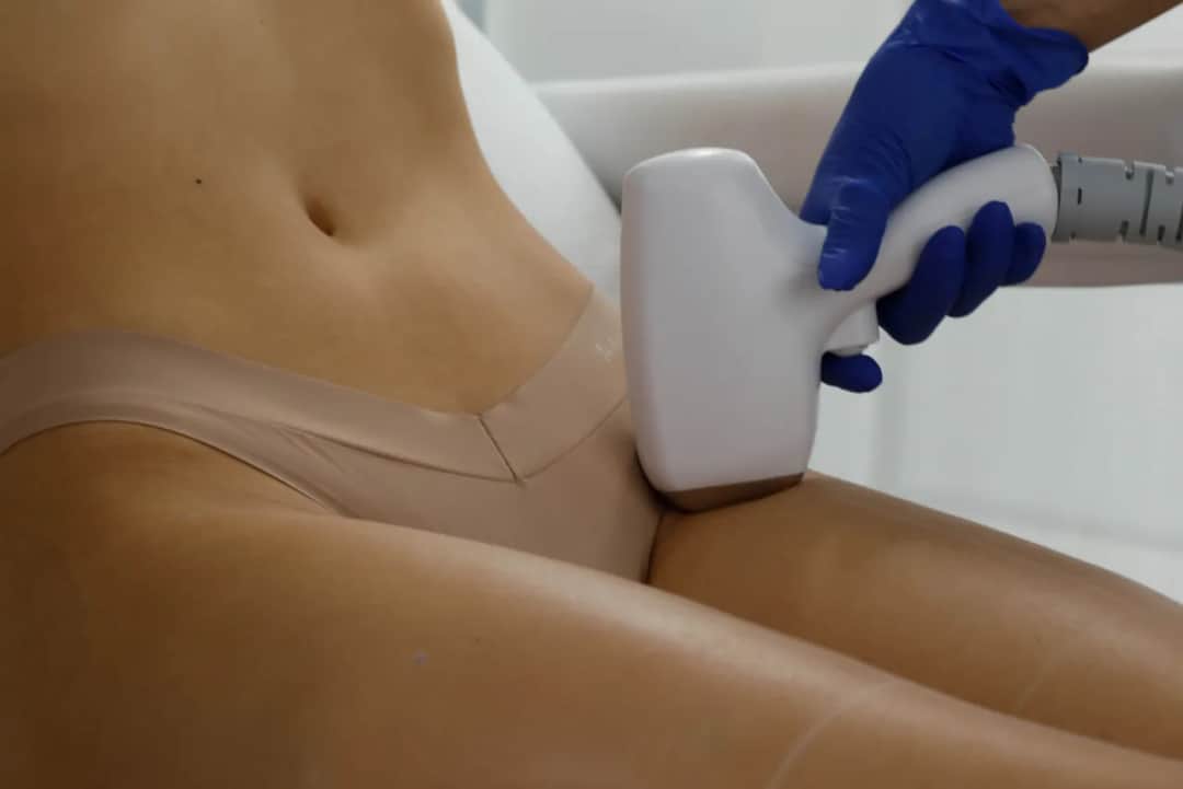 Co to jest depilacja brazylijska i jak uniknąć bólu podczas zabiegu