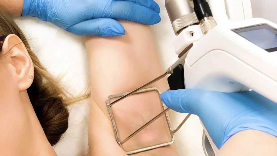 Jak działa laser do depilacji i co warto wiedzieć przed zabiegiem