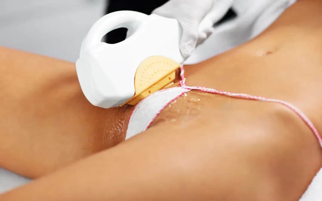 Co obejmuje bikini brazylijskie? Zaskakujące szczegóły depilacji