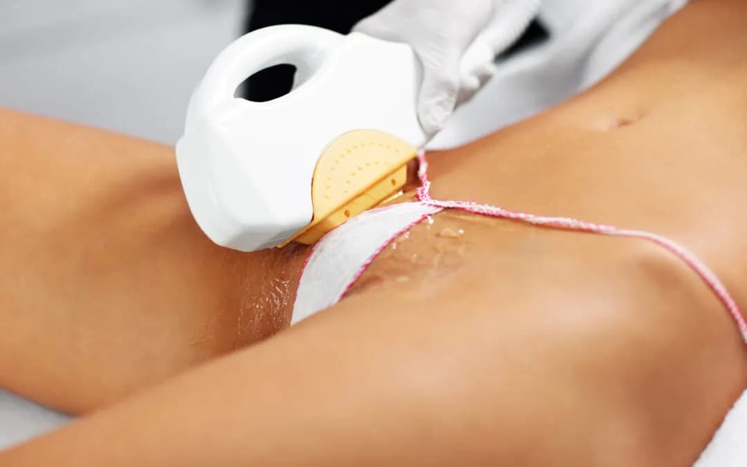 Co obejmuje bikini brazylijskie? Zaskakujące szczegóły depilacji