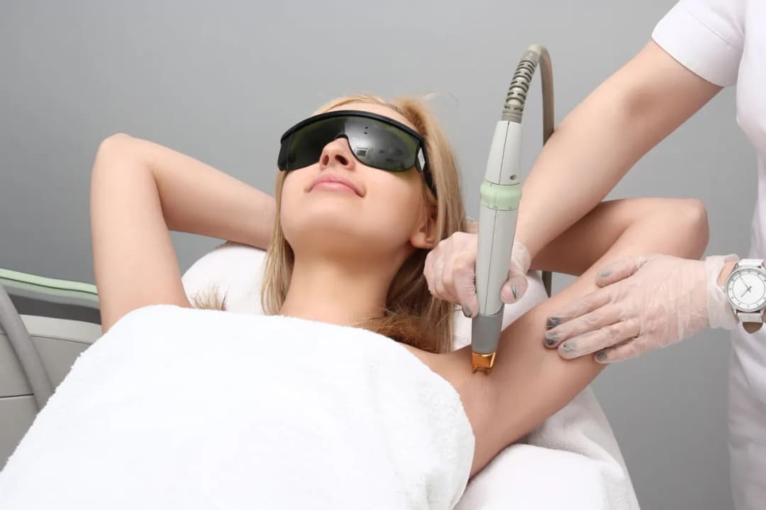 Depilacja laserowa jaki laser wybrać dla najlepszych efektów?