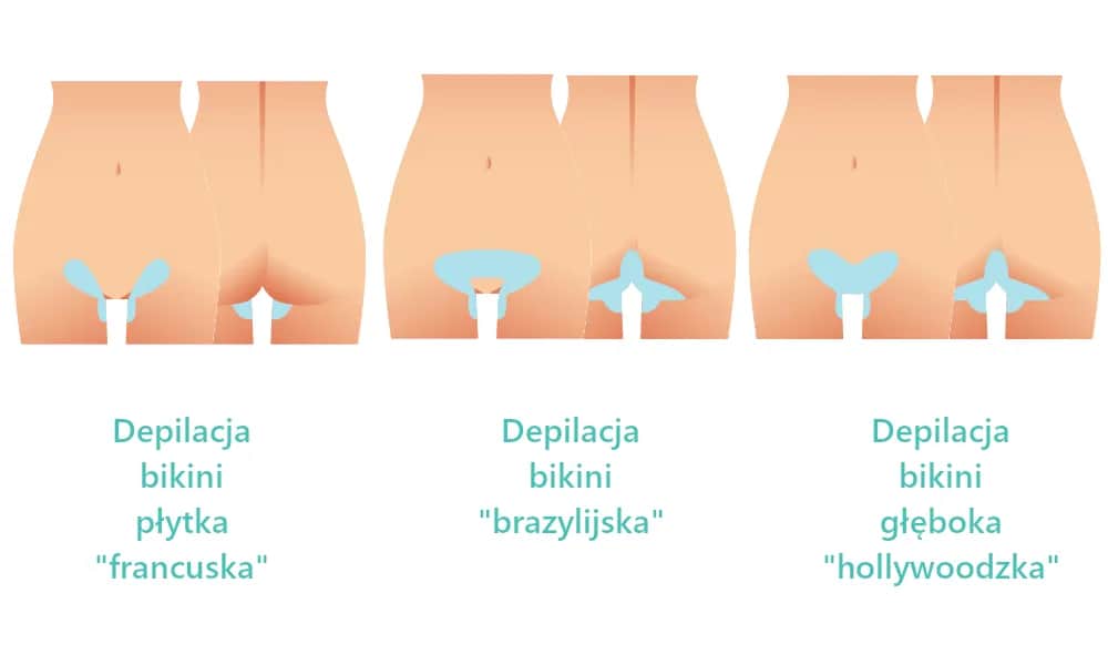Depilacja bikini płytkie – co obejmuje i jakie ma zalety?